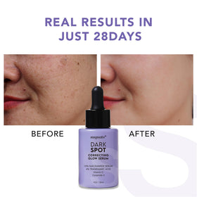 Before and after concept showing improved skin tone with Suquato serum.