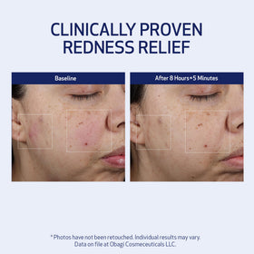 Cream swirl applied to skin demonstrates smooth absorption and texture improvement.