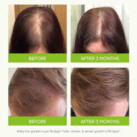 Svvimer Batana and Castor Oil blend bottle nourishing scalp and strands.