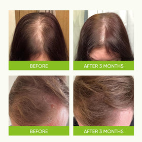 Caffeine boost visual emphasizes scalp conditioning for a fuller appearance with Svvimer