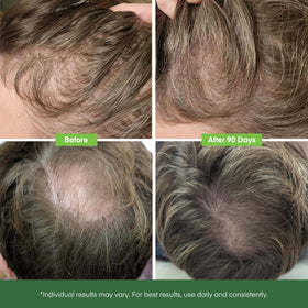 Svvimer rosemary and batana oil blend for healthier-looking hair