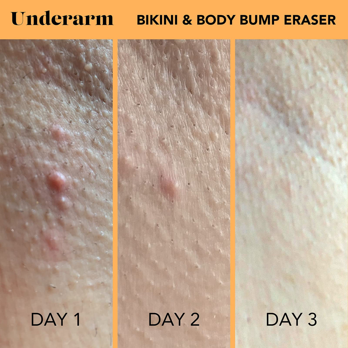 SweetSpot Labs azelaic acid ingredient close-up for bump targeting