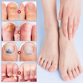 Taakcc herbal extract patch highlighting gentle, non-irritating formula for nails.