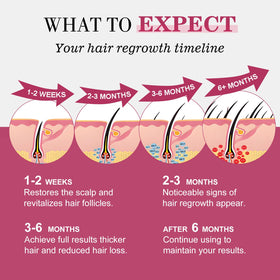 TAGOQHIA Women’s thinning hair care routine showing targeted regrowth support.