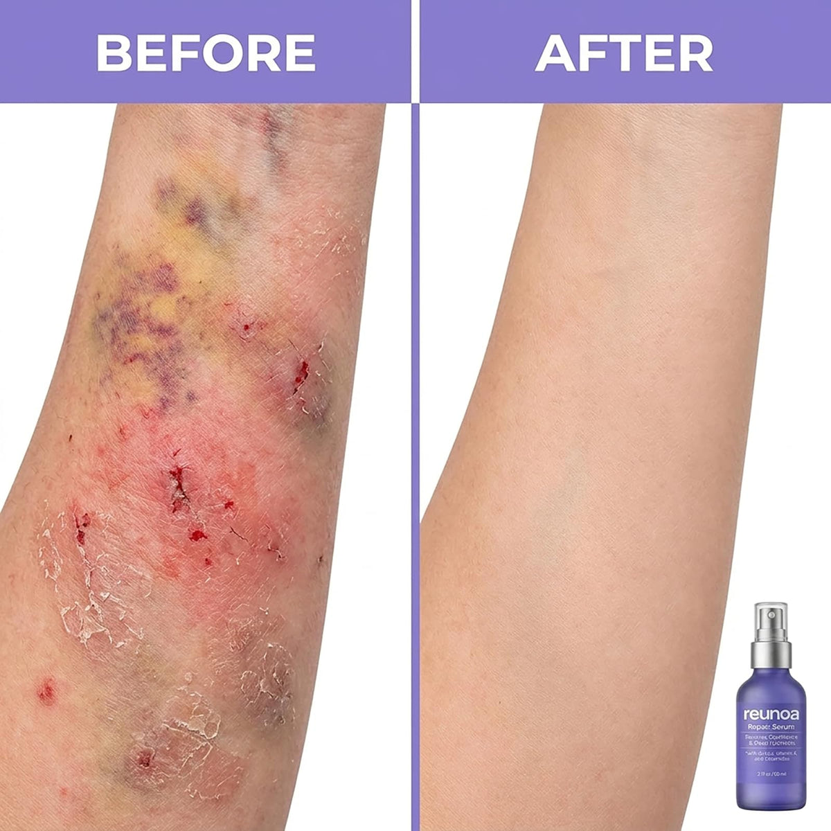 TAWODIUM Reunoa Repair Serum packaging highlights ceramides and Vitamin K.