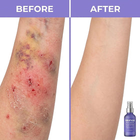 TAWODIUM Reunoa Repair Serum packaging highlights ceramides and Vitamin K.