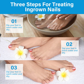 TDZLDM applied area on toe showing gentle formula at work.