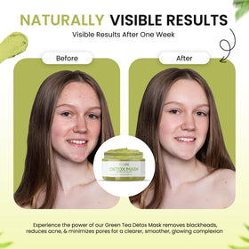 Teami Detox Mask rinse-off shows warm water removal and refreshed skin.