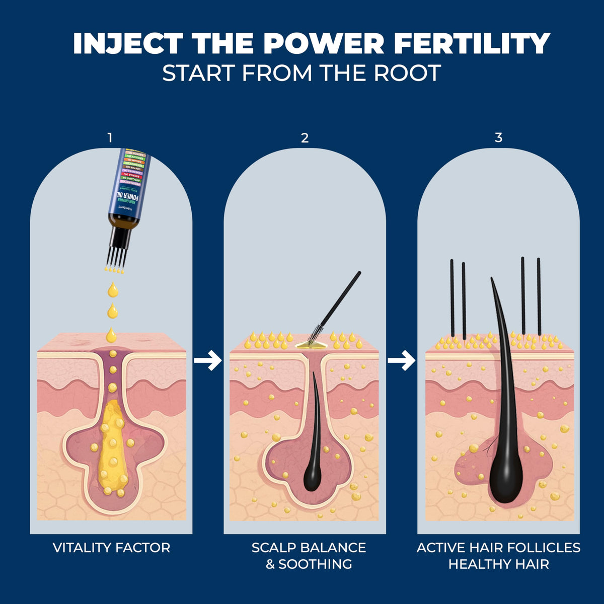 Technobeauty Precision applicator tip targets the scalp.