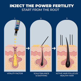 Technobeauty Precision applicator tip targets the scalp.
