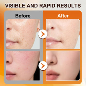 TEHCIN Salmon DNA Ampoule routine shot illustrates easy integration into skincare