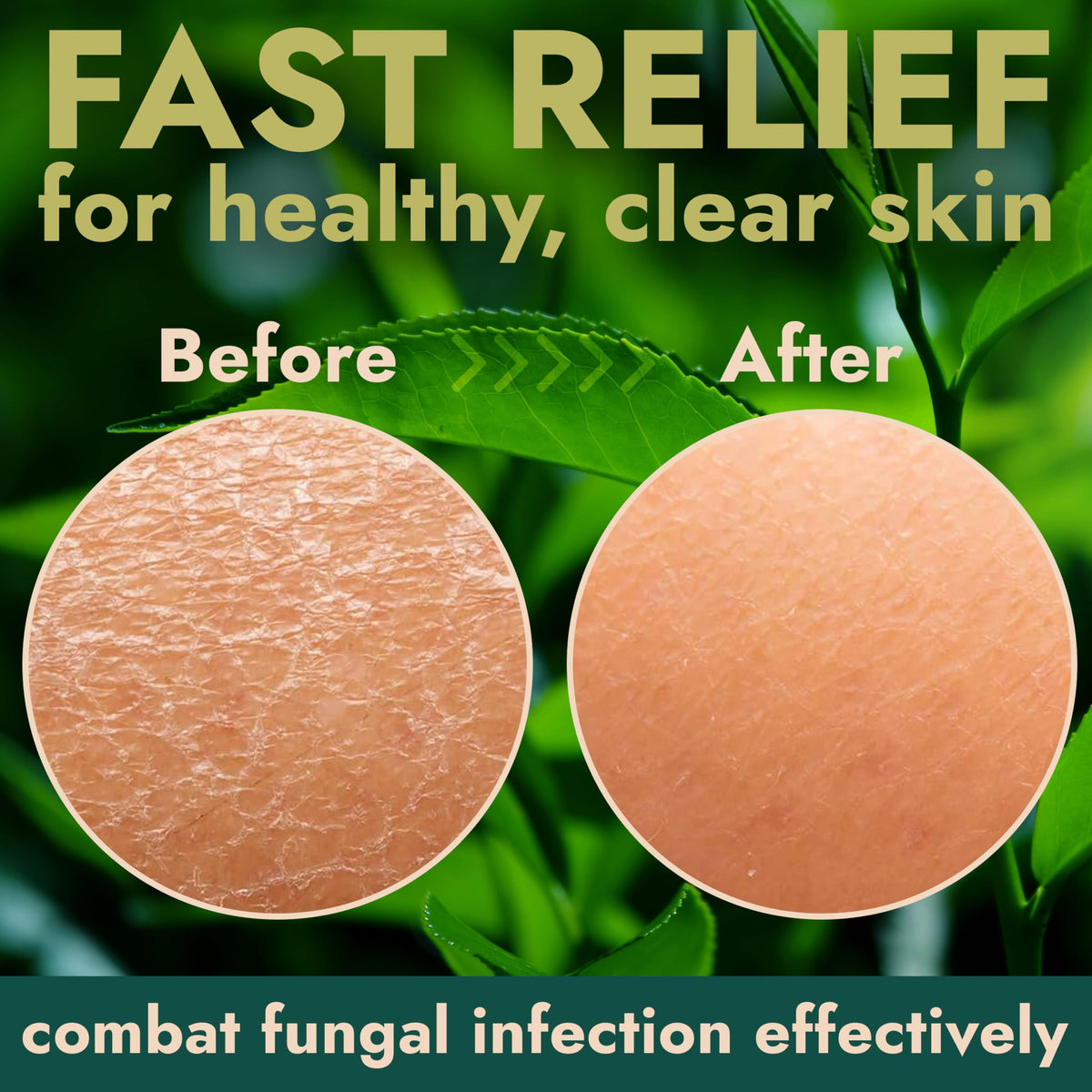 Terramed Just Think Comfort antifungal soap with rich lather for a crisp feel.