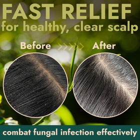 Terramed Just Think Comfort Tea Tree Scalp Scrub quartz powder and sea salt visible for natural exfoliation.