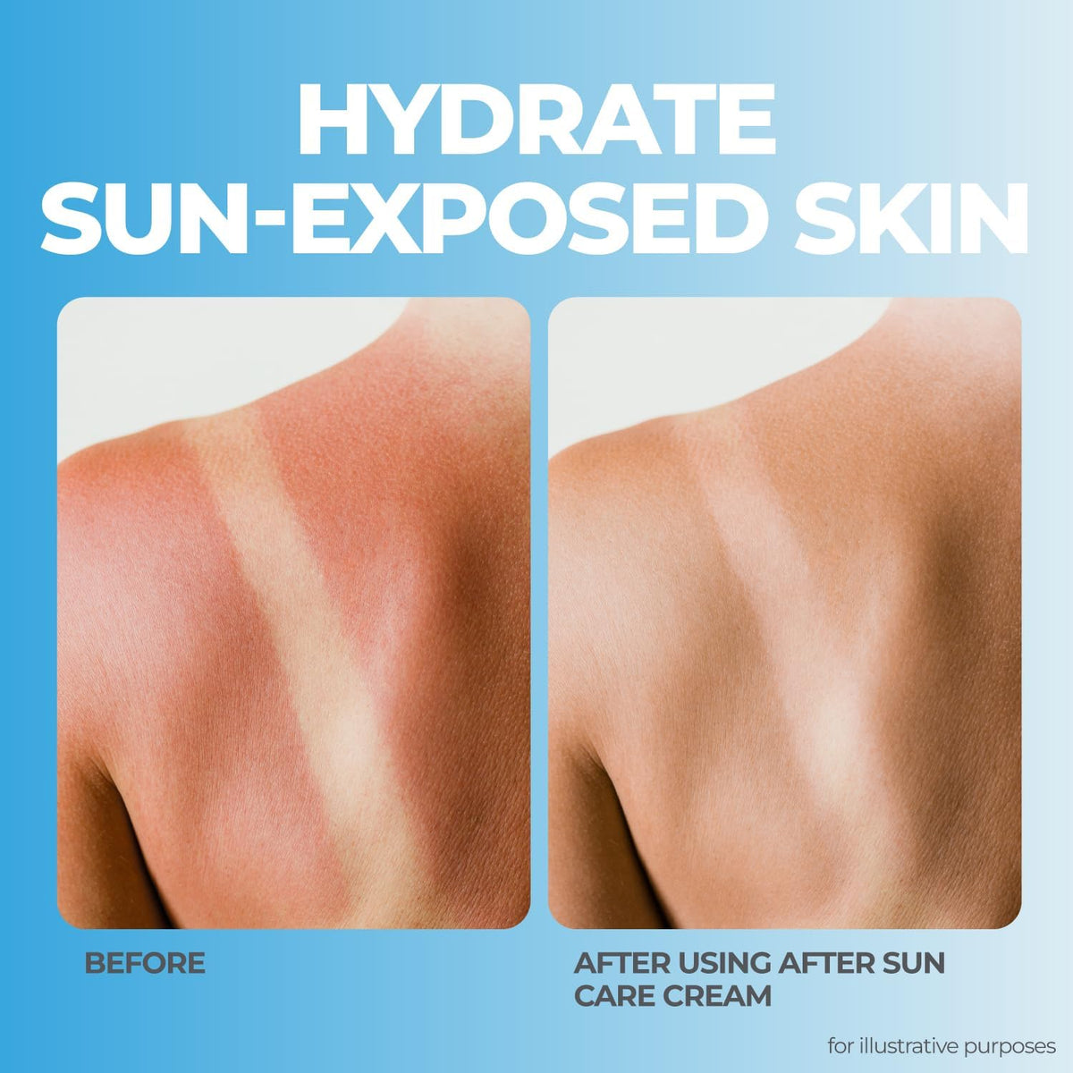 Terrasil After Sun Lotion with shea butter providing deep moisture after sun.