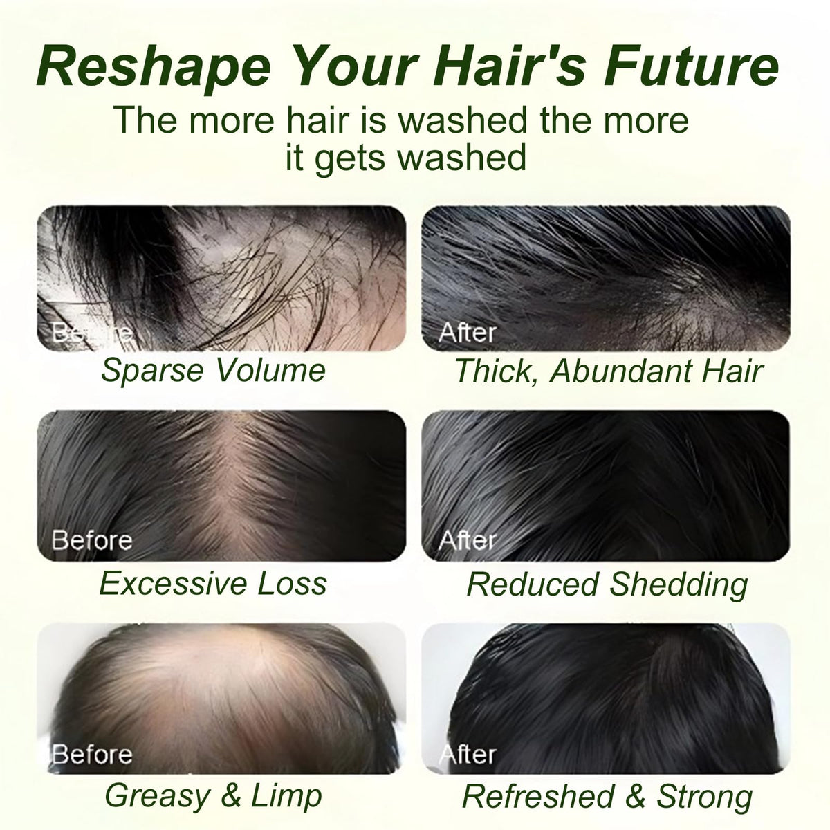 Tgideas Batana Oil Rosemary Shampoo scalp shot suggests soothing hydration
