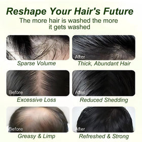 Tgideas Batana Oil Rosemary Shampoo scalp shot suggests soothing hydration