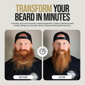 The Beard Struggle Mag X base charging station for cordless grooming convenience.