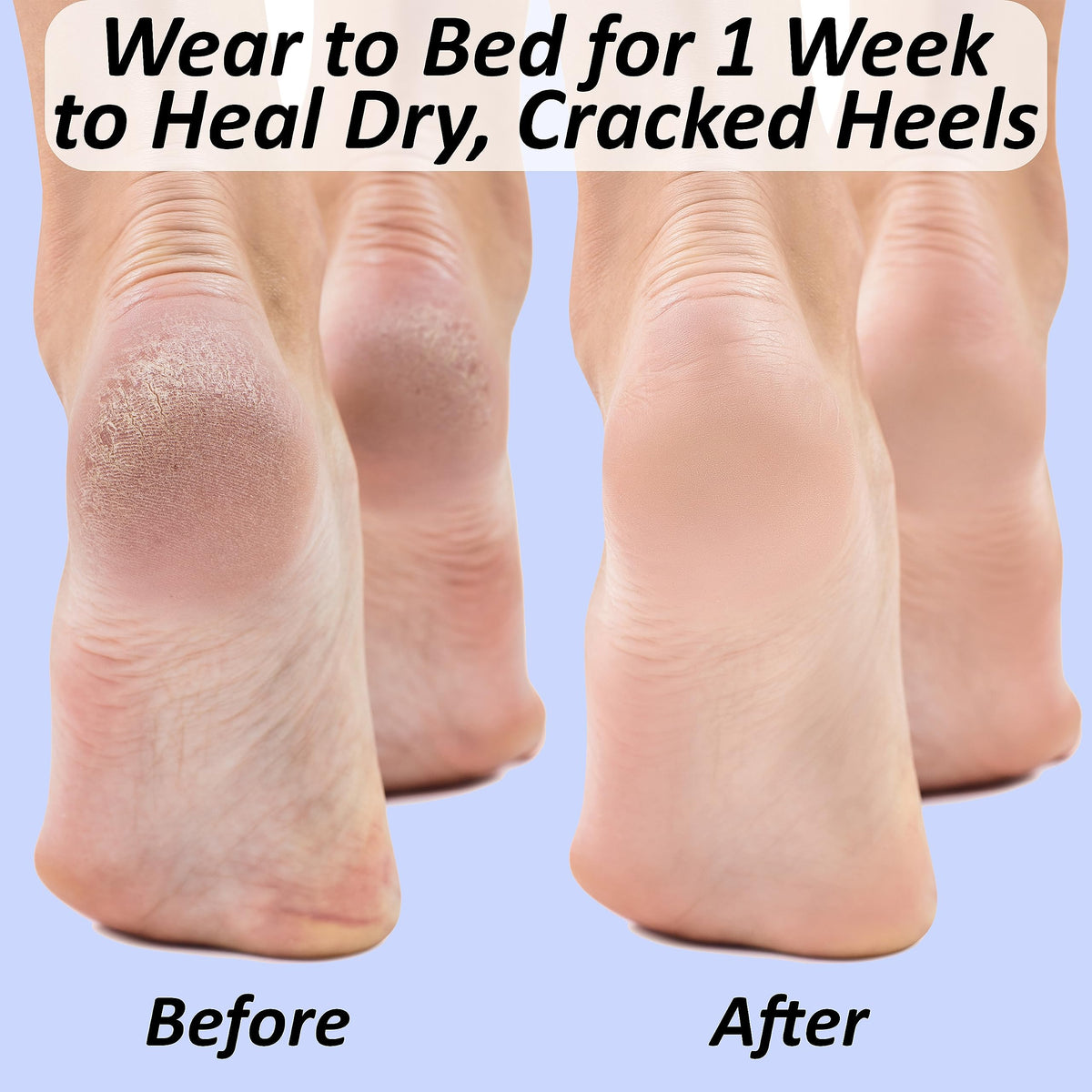 The Foot Medic washable and durable gel socks for repeated use