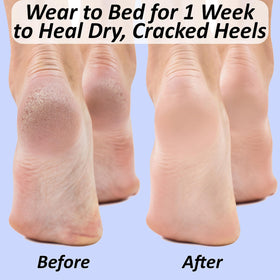 The Foot Medic washable and durable gel socks for repeated use