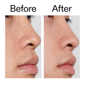 The INKEY List PHA Toner after-application glow on skin.