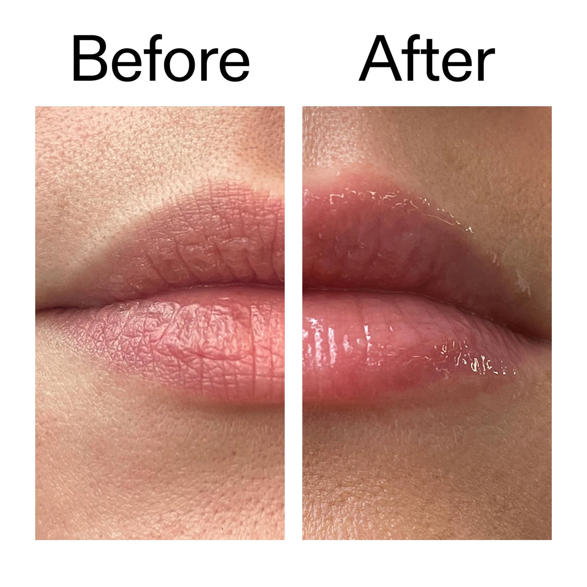 Daylight view of hydrated lips with defined contours from The INKEY List Lip Balm.