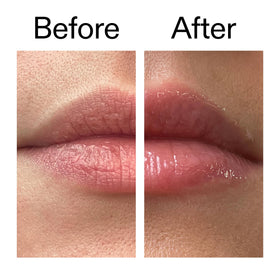 Daylight view of hydrated lips with defined contours from The INKEY List Lip Balm.