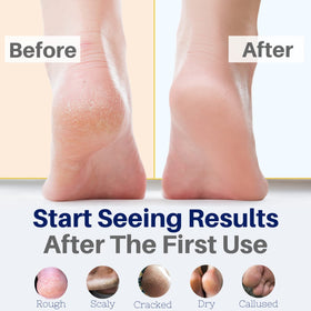 Creamy texture swatch of The Yellow Bird Foot Cream ideal for dry, cracked feet.