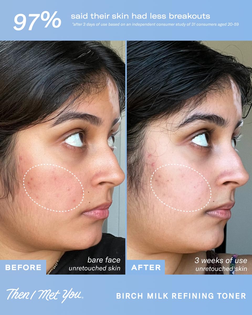Then I Met You Birch Milk Toner travel-friendly bottle for on-the-go skincare.