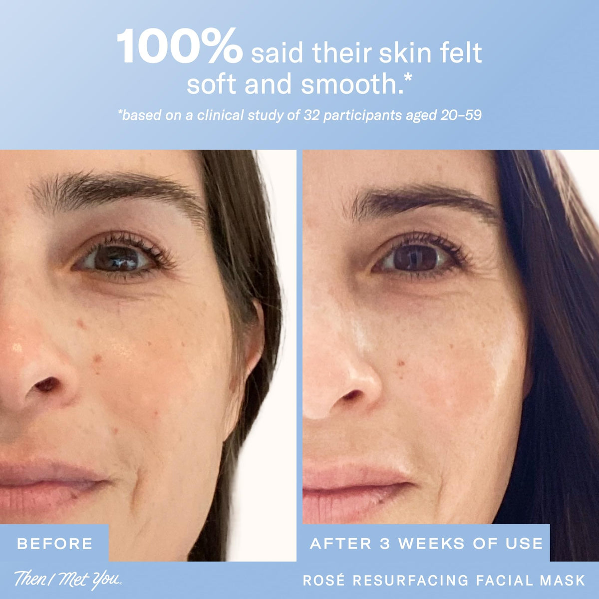 Then I Met You Rosé Resurfacing Mask application on clean skin