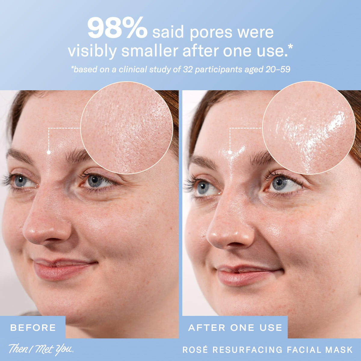 Then I Met You Rosé Resurfacing Mask rinse reveals brighter, smoother texture