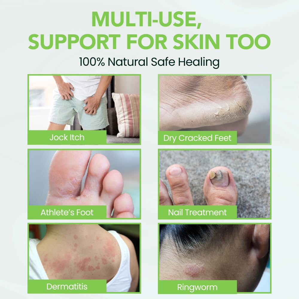 Thena Athletes Foot Cream packaging front with logo and labeling close-up.