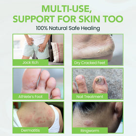 Thena Athletes Foot Cream packaging front with logo and labeling close-up.
