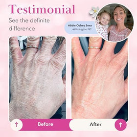 Fragrance-free Theraplex formula shown as a gentle option.