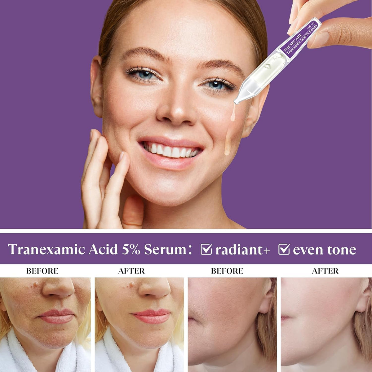THESKCARE glowing hydrated skin after serum application