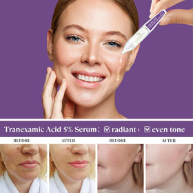 THESKCARE glowing hydrated skin after serum application