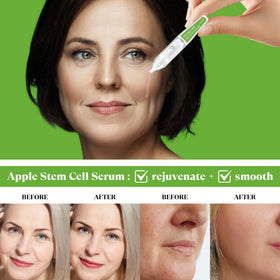 THESKCARE serum application on face close-up for quick absorption