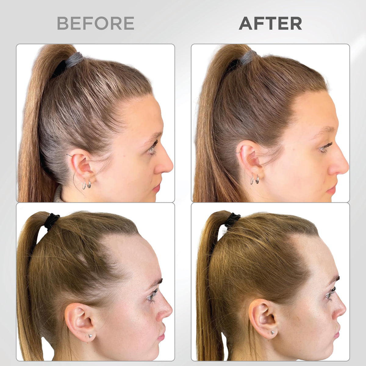 THICK FIBER precision application brush enables precise touch-ups on thinning hair.