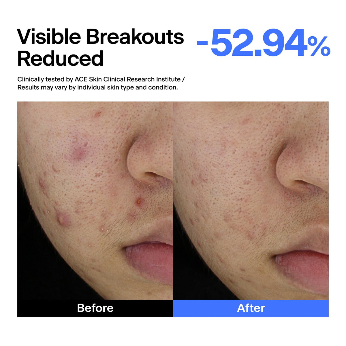 THOME ABC Serum azelaic acid visual highlights texture refinement