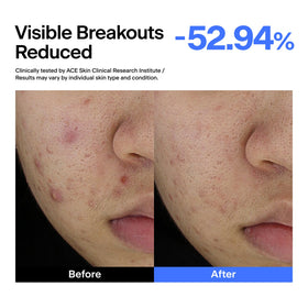THOME ABC Serum azelaic acid visual highlights texture refinement