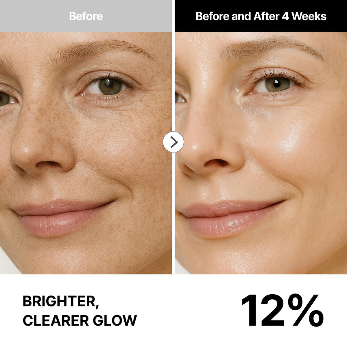 THOME G-Peel Calm step calms redness and prepares skin barrier.