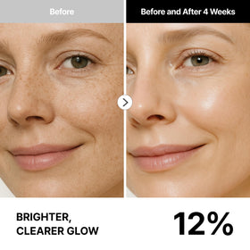 THOME G-Peel Calm step calms redness and prepares skin barrier.