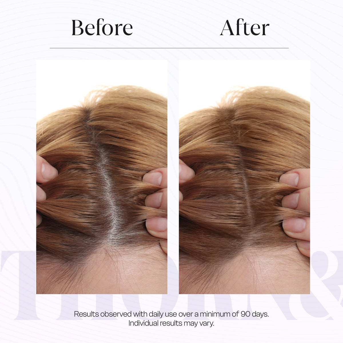 THORN & BERRY Peptide serum application on scalp.