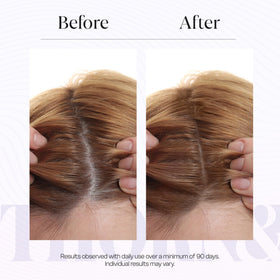 THORN & BERRY Peptide serum application on scalp.