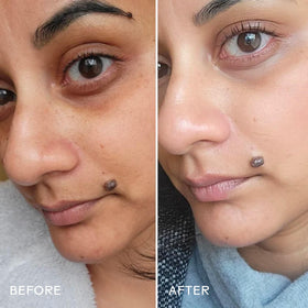 Three Ships Brighter Days eye masks in-use under-eye area depiction emphasizes depuffing.