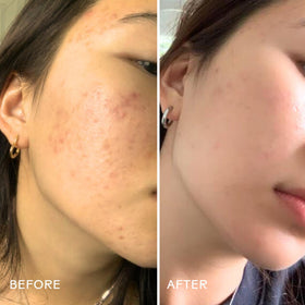 Purify Aloe cleanser on skin suggests a refreshing, non-drying wash.