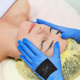 Threlaco hygienic disposal after dermaplaning session.