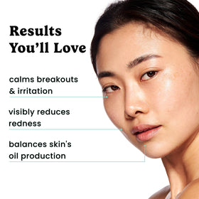 Timeless Oily skin routine application scene with soothing serum.