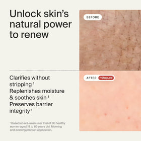 Timeline Mitopure cleanser enriched with ceramides protects the lipid barrier.