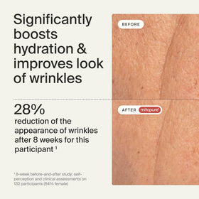 Timeline Mitopure ingredients label highlights niacinamide and trehalose.