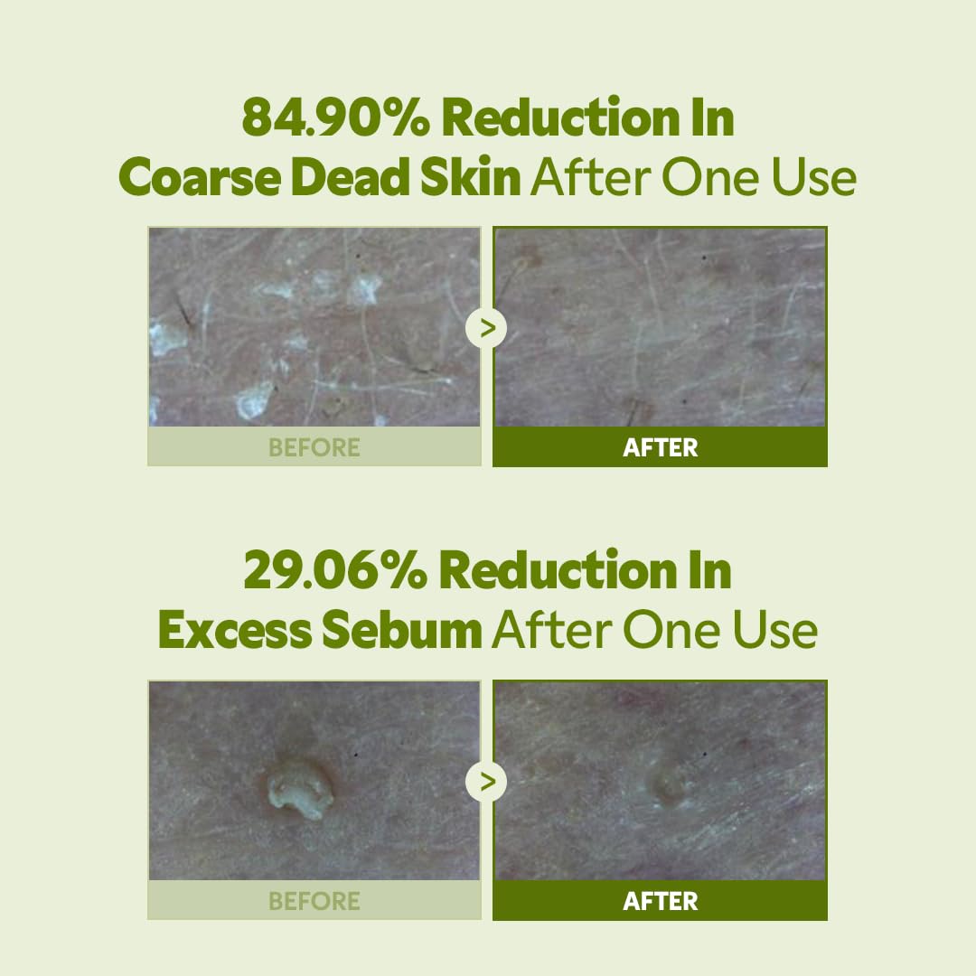 6-Ceramide Complex strengthens barrier while keeping skin hydrated after exfoliation.